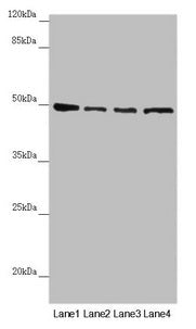 Western blot All lanes: AP1M1 antibody at 1.43µg/ml Lane 1: A375 whole cell lysate Lane 2: Jurkat whole cell lysate Lane 3: Hela whole cell lysate Lane 4: HepG2 whole cell lysate Secondary Goat polyclonal to rabbit IgG at 1/10000 dilution Predicted band size: 49, 50 kDa Observed band size: 49 kDa
