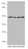 Western blot All lanes: AP1M1 antibody at 1.38µg/ml Lane 1: A375 whole cell lysate Lane 2: Jurkat whole cell lysate Lane 3: Hela whole cell lysate Lane 4: HepG2 whole cell lysate Secondary Goat polyclonal to rabbit IgG at 1/10000 dilution Predicted band size: 49, 50 kDa Observed band size: 49 kDa