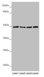 Western blot All lanes: AP1M1 antibody at 1.38µg/ml Lane 1: A375 whole cell lysate Lane 2: Jurkat whole cell lysate Lane 3: Hela whole cell lysate Lane 4: HepG2 whole cell lysate Secondary Goat polyclonal to rabbit IgG at 1/10000 dilution Predicted band size: 49, 50 kDa Observed band size: 49 kDa