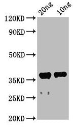 Western Blot
Positive WB detected in Recombinant protein
All lanes: ache antibody at 2.3µg/ml
Secondary
Goat polyclonal to rabbit IgG at 1/50000 dilution
Predicted band size: 44 kDa
Observed band size: 38 kDa