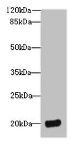 Western blot
All lanes: DEFB129 antibody at 8µg/ml + HL60 whole cell lysate
Secondary
Goat polyclonal to rabbit IgG at 1/10000 dilution
Predicted band size: 21 kDa
Observed band size: 21 kDa