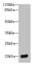 Western blot
All lanes: DEFB129 antibody at 8µg/ml + HL60 whole cell lysate
Secondary
Goat polyclonal to rabbit IgG at 1/10000 dilution
Predicted band size: 21 kDa
Observed band size: 21 kDa