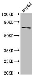 Western Blot
Positive WB detected in: HepG2 whole cell lysate
All lanes: ABCG5 antibody at 8.7µg/ml
Secondary
Goat polyclonal to rabbit IgG at 1/50000 dilution
Predicted band size: 73, 29 kDa
Observed band size: 73 kDa