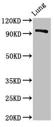 Western Blot
Positive WB detected in: Rat lung tissue
All lanes: VPS16 antibody at 3ug/ml
Secondary
Goat polyclonal to rabbit IgG at 1/50000 dilution
Predicted band size: 95, 79 kDa
Observed band size: 95 kDa