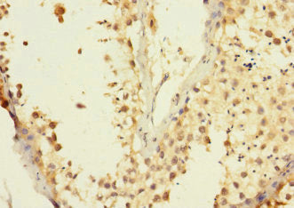 Immunohistochemistry of paraffin-embedded human testis tissue using CSB-PA863964LA01HU at dilution of 1:100