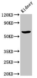 Western Blot
Positive WB detected in: Rat kidney tissue
All lanes: ACBD3 antibody at 7ug/ml
Secondary
Goat polyclonal to rabbit IgG at 1/50000 dilution
Predicted band size: 61 kDa
Observed band size: 61 kDa