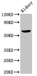 Western Blot
Positive WB detected in: Rat kidney tissue
All lanes: ACBD3 antibody at 7ug/ml
Secondary
Goat polyclonal to rabbit IgG at 1/50000 dilution
Predicted band size: 61 kDa
Observed band size: 61 kDa