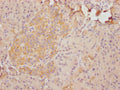 IHC image of CSB-PA864019LA01HU diluted at 1:100 and staining in paraffin-embedded human pancreatic tissue performed on a Leica BondTM system. After dewaxing and hydration, antigen retrieval was mediated by high pressure in a citrate buffer (pH 6.0). Section was blocked with 10% normal goat serum 30min at RT. Then primary antibody (1% BSA) was incubated at 4°C overnight. The primary is detected by a Goat anti-rabbit polymer IgG labeled by HRP and visualized using 0.05% DAB.