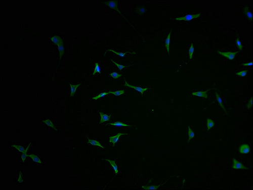 Immunofluorescence staining of SH-SY5Y cells with CSB-PA864031LA01HU-IF at 1:100, counter-stained with DAPI. The cells were fixed in 4% formaldehyde and blocked in 10% normal Goat Serum. The cells were then incubated with the antibody overnight at 4°C. The secondary antibody was Alexa Fluor 488-congugated AffiniPure Goat Anti-Rabbit IgG(H+L).