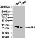 Western Blot
Positive WB detected in: recombinant protein
All lanes: AFP2 Antibody at 1:1000
Secondary
Goat polyclonal to rabbit IgG at 1/50000 dilution
Predicted band size: 21 kDa
Observed band size: 27 kDa