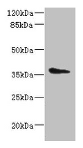 Western blot
All lanes: AASDHPPT antibody at 2µg/ml + HepG2 whole cell lysate
Secondary
Goat polyclonal to rabbit IgG at 1/10000 dilution
Predicted band size: 36, 16 kDa
Observed band size: 36 kDa