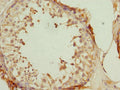 Immunohistochemistry of paraffin-embedded human testis tissue using CSB-PA865123DSR2HU at dilution of 1:100