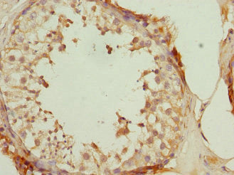 Immunohistochemistry of paraffin-embedded human testis tissue using CSB-PA865123DSR2HU at dilution of 1:100