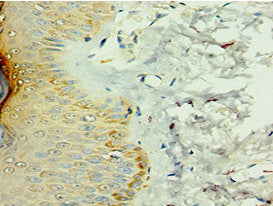 Immunohistochemistry of paraffin-embedded human skin tissue using CSB-PA866201DSR1HU at dilution of 1:100