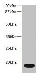 Western blot
All lanes: IL36RN antibody at 16µg/ml + Mouse stomach tissue
Secondary
Goat polyclonal to rabbit IgG at 1/10000 dilution
Predicted band size: 17 kDa
Observed band size: 17 kDa