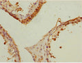Immunohistochemistry of paraffin-embedded human testis tissue using CSB-PA866205ESR1HU at dilution of 1:100