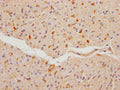 IHC image of CSB-PA866209NA01HU diluted at 1:100 and staining in paraffin-embedded human heart tissue performed on a Leica BondTM system. After dewaxing and hydration, antigen retrieval was mediated by high pressure in a citrate buffer (pH 6.0). Section was blocked with 10% normal goat serum 30min at RT. Then primary antibody (1% BSA) was incubated at 4°C overnight. The primary is detected by a Goat anti-rabbit polymer IgG labeled by HRP and visualized using 0.05% DAB.