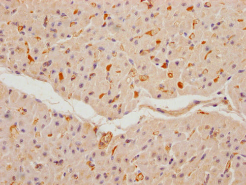 IHC image of CSB-PA866209NA01HU diluted at 1:100 and staining in paraffin-embedded human heart tissue performed on a Leica BondTM system. After dewaxing and hydration, antigen retrieval was mediated by high pressure in a citrate buffer (pH 6.0). Section was blocked with 10% normal goat serum 30min at RT. Then primary antibody (1% BSA) was incubated at 4°C overnight. The primary is detected by a Goat anti-rabbit polymer IgG labeled by HRP and visualized using 0.05% DAB.