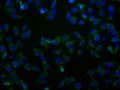 Immunofluorescence staining of HepG2 cells with CSB-PA866221LA01HU at 1:100, counter-stained with DAPI. The cells were fixed in 4% formaldehyde and blocked in 10% normal Goat Serum. The cells were then incubated with the antibody overnight at 4°C. The secondary antibody was Alexa Fluor 488-congugated AffiniPure Goat Anti-Rabbit IgG(H+L).