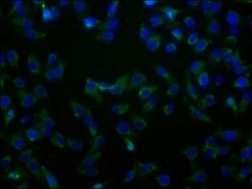 Immunofluorescence staining of HepG2 cells with CSB-PA866221LA01HU at 1:100, counter-stained with DAPI. The cells were fixed in 4% formaldehyde and blocked in 10% normal Goat Serum. The cells were then incubated with the antibody overnight at 4°C. The secondary antibody was Alexa Fluor 488-congugated AffiniPure Goat Anti-Rabbit IgG(H+L).