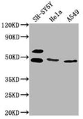 Western Blot
Positive WB detected in: SH-SY5Y whole cell lysate, Hela whole cell lysate, A549 whole cell lysate
All lanes: ANGPTL4 antibody at 1:1000
Secondary
Goat polyclonal to rabbit IgG at 1/50000 dilution
Predicted band size: 46, 41, 27 kDa
Observed band size: 46 kDa