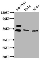 Western Blot
Positive WB detected in: SH-SY5Y whole cell lysate, Hela whole cell lysate, A549 whole cell lysate
All lanes: ANGPTL4 antibody at 1:1000
Secondary
Goat polyclonal to rabbit IgG at 1/50000 dilution
Predicted band size: 46, 41, 27 kDa
Observed band size: 46 kDa