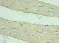 Immunohistochemistry of paraffin-embedded human skeletal muscle tissue using CSB-PA866314ESR1HU at dilution of 1:100