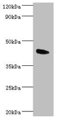 Western blot
All lanes: Angiopoietin-related protein 4 antibody at 2ug/ml + Mouse heart tissue
Secondary
Goat polyclonal to rabbit IgG at 1/10000 dilution
Predicted band size: 46, 41, 27 kDa
Observed band size: 46 kDa