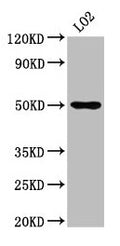 Western Blot
Positive WB detected in: LO2 whole cell lysate
All lanes: AGXT2 antibody at 4.9µg/ml
Secondary
Goat polyclonal to rabbit IgG at 1/50000 dilution
Predicted band size: 58, 50 kDa
Observed band size: 50 kDa