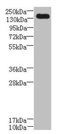 Western blot
All lanes: UBE2O antibody at 0.8µg/ml + A431 whole cell lysate
Secondary
Goat polyclonal to rabbit IgG at 1/10000 dilution
Predicted band size: 142 kDa
Observed band size: 142 kDa