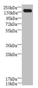 Western blot
All lanes: UBE2O antibody at 0.8µg/ml + A431 whole cell lysate
Secondary
Goat polyclonal to rabbit IgG at 1/10000 dilution
Predicted band size: 142 kDa
Observed band size: 142 kDa
