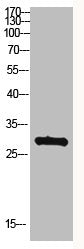 Western Blot analysis of hepg2 cells using Antibody diluted at 500. Secondary antibody  was diluted at 1:20000