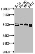 Western Blot
Positive WB detected in: HeLa whole cell lysate, HL-60 whole cell lysate, K562 whole cell lysate, 293T whole cell lysate
All lanes: DDX47 antibody at 1:2000
Secondary
Goat polyclonal to rabbit IgG at 1/50000 dilution
Predicted band size: 51, 46 kDa
Observed band size: 51 kDa