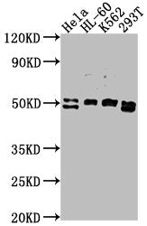 Western Blot
Positive WB detected in: HeLa whole cell lysate, HL-60 whole cell lysate, K562 whole cell lysate, 293T whole cell lysate
All lanes: DDX47 antibody at 1:2000
Secondary
Goat polyclonal to rabbit IgG at 1/50000 dilution
Predicted band size: 51, 46 kDa
Observed band size: 51 kDa