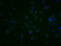 Immunofluorescence staining of PC3 cells with CSB-PA867147LA01HU at 1:200, counter-stained with DAPI. The cells were fixed in 4% formaldehyde and blocked in 10% normal Goat Serum. The cells were then incubated with the antibody overnight at 4°C. The secondary antibody was Alexa Fluor 488-congugated AffiniPure Goat Anti-Rabbit IgG(H+L).