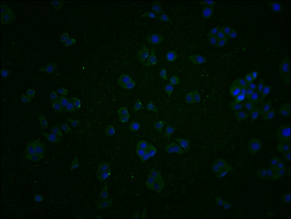 Immunofluorescence staining of PC3 cells with CSB-PA867147LA01HU at 1:200, counter-stained with DAPI. The cells were fixed in 4% formaldehyde and blocked in 10% normal Goat Serum. The cells were then incubated with the antibody overnight at 4°C. The secondary antibody was Alexa Fluor 488-congugated AffiniPure Goat Anti-Rabbit IgG(H+L).