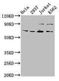 Western Blot
Positive WB detected in: Hela whole cell lysate, 293T whole cell lysate, Jurkat whole cell lysate, K562 whole cell lysate
All lanes: ALG9 antibody at 6.3µg/ml
Secondary
Goat polyclonal to rabbit IgG at 1/50000 dilution
Predicted band size: 70, 51, 71, 52 kDa
Observed band size: 70 kDa