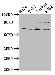 Western Blot
Positive WB detected in: Hela whole cell lysate, 293T whole cell lysate, Jurkat whole cell lysate, K562 whole cell lysate
All lanes: ALG9 antibody at 6.3µg/ml
Secondary
Goat polyclonal to rabbit IgG at 1/50000 dilution
Predicted band size: 70, 51, 71, 52 kDa
Observed band size: 70 kDa