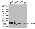 Western Blot
Positive WB detected in: recombinant protein
All lanes:tbx20 Antibody at 1:1000
Secondary
Goat polyclonal to rabbit IgG at 1/20000 dilution
Predicted band size: 26.42 kDa
Observed band size: 28 kDa