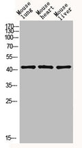 Western blot analysis of mouse-lung mouse-heart mouse-liver lysis using EDA antibody. Antibody was diluted at 1:1000. Secondary antibody  was diluted at 1:20000