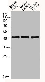 Western blot analysis of mouse-lung mouse-heart mouse-liver lysis using EDA antibody. Antibody was diluted at 1:1000. Secondary antibody  was diluted at 1:20000