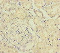 Immunohistochemistry of paraffin-embedded human kidney tissue using CSB-PA868276ESR1HU at dilution of 1:100