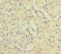 Immunohistochemistry of paraffin-embedded human kidney tissue using CSB-PA868276ESR1HU at dilution of 1:100
