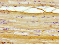 Immunohistochemistry of paraffin-embedded human skeletal muscle tissue using CSB-PA868282LA01HU at dilution of 1:100