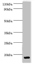 Western blot
All lanes: C-C motif chemokine 28 antibody at 5ug/ml + Mouse spleen tissue
Secondary
Goat polyclonal to rabbit IgG at 1/10000 dilution
Predicted band size: 15, 13 kDa
Observed band size: 15 kDa