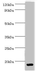 Western blot
All lanes: C-C motif chemokine 28 antibody at 5ug/ml + Mouse spleen tissue
Secondary
Goat polyclonal to rabbit IgG at 1/10000 dilution
Predicted band size: 15, 13 kDa
Observed band size: 15 kDa