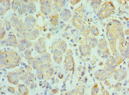 Immunohistochemistry of paraffin-embedded human salivary gland tissue using CSB-PA868302ESR2HU at dilution of 1:100