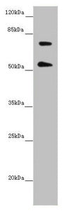 Western blot All lanes: ABCB8 antibody at 2.02 ug/ml + Mouse heart tissue Secondary Goat polyclonal to rabbit IgG at 1/10000 dilution Predicted band size: 80, 79, 76, 69, 60 kDa Observed band size: 80, 55 kDa