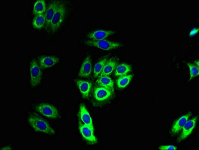 Immunofluorescent analysis of HepG2 cells using CSB-PA868343LA01HU at dilution of 1:100 and Alexa Fluor 488-congugated AffiniPure Goat Anti-Rabbit IgG(H+L)