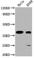 Western Blot
Positive WB detected in: Hela whole cell lysate, A549 whole cell lysate
All lanes: TAS2R7 antibody at 1:2000
Secondary
Goat polyclonal to rabbit IgG at 1/50000 dilution
Predicted band size: 37 kDa
Observed band size: 37 kDa
